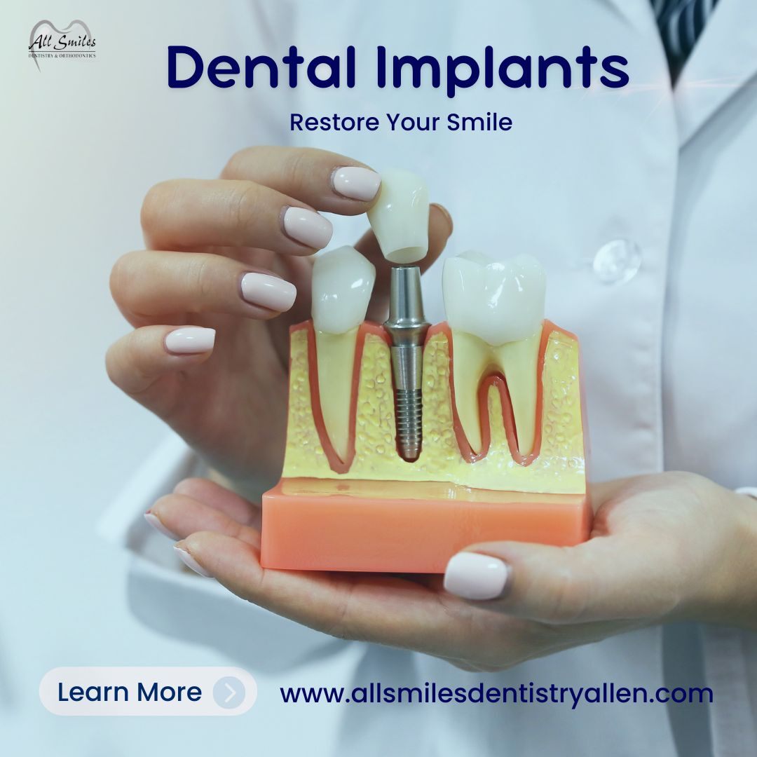 Restore Your Smile with Durable Dental Implants in Allen, TX